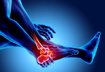 How to Prevent and Treat Heel Spurs: Optima Foot and Ankle