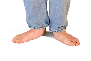 Dealing With Flat Feet