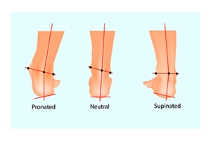 The Dangers of Excessive Supination